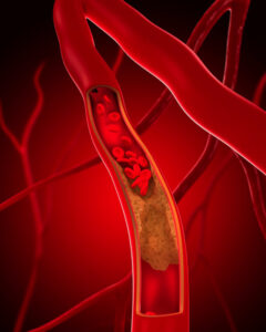 Illustration of veins