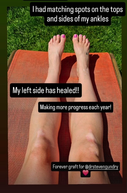 Simply Plant Paradox