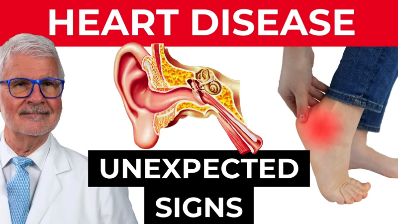 Heart Disease - Unexpected Signs